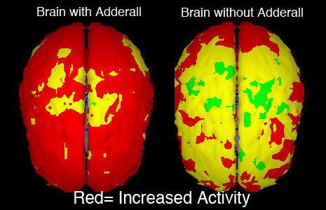 With adderall withdrawal symptoms help